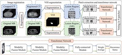 Recurrence risk stratification for locally advanced cervical cancer using multi-modality transformer network